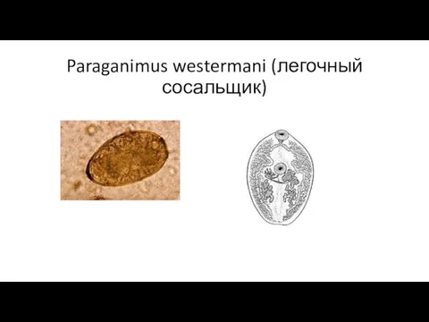 Paraganimus westermani (легочный сосальщик)