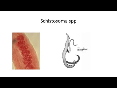 Schistosoma spp