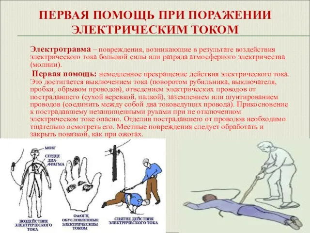 ПЕРВАЯ ПОМОЩЬ ПРИ ПОРАЖЕНИИ ЭЛЕКТРИЧЕСКИМ ТОКОМ Электротравма – повреждения, возникающие в результате