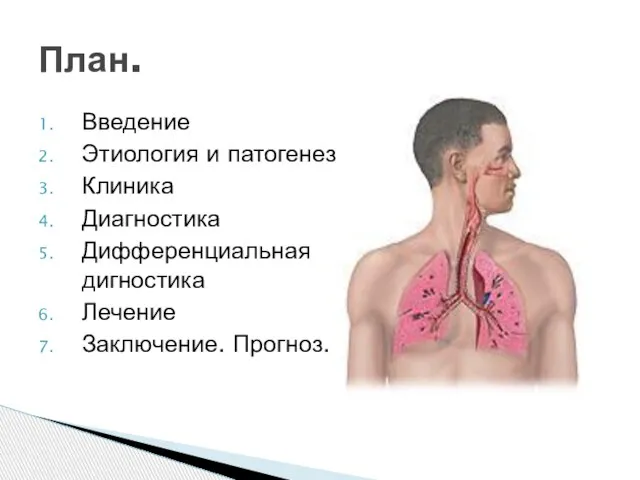 Введение Этиология и патогенез Клиника Диагностика Дифференциальная дигностика Лечение Заключение. Прогноз. План.