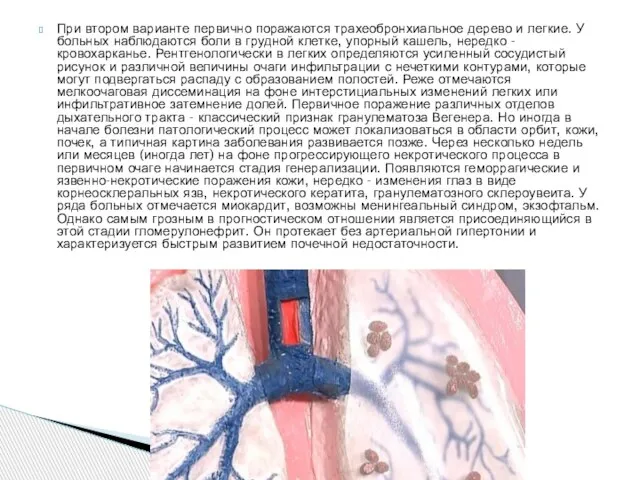 При втором варианте первично поражаются трахеобронхиальное дерево и легкие. У больных наблюдаются