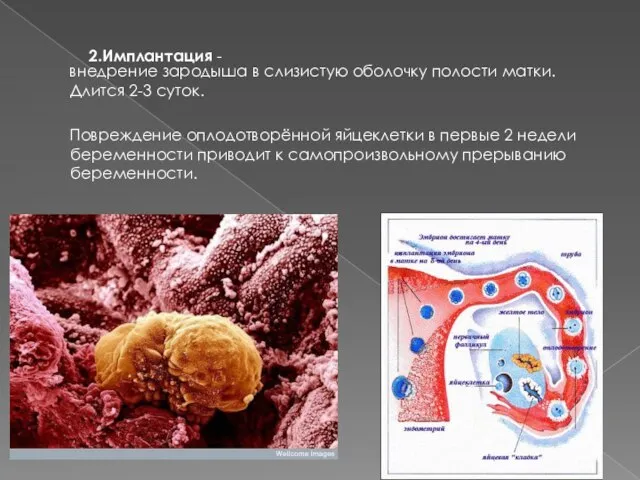 2.Имплантация внедрение зародыша в слизистую оболочку полости матки. Длится 2-3 суток. Повреждение