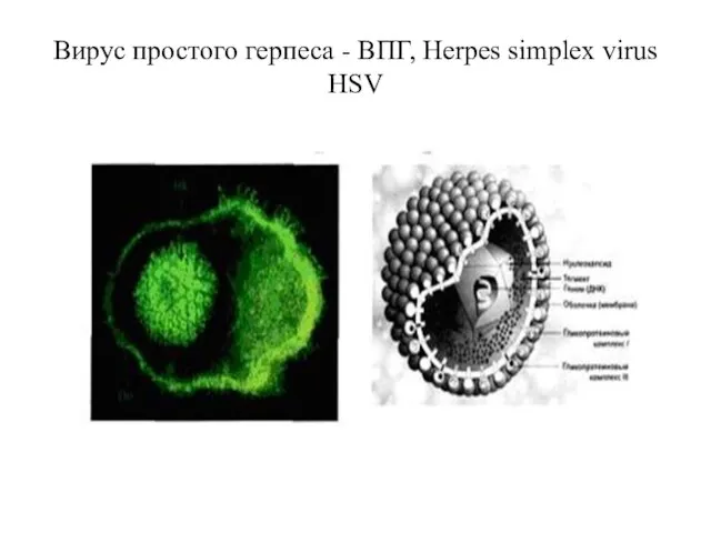Вирус простого герпеса - ВПГ, Herpes simplex virus HSV