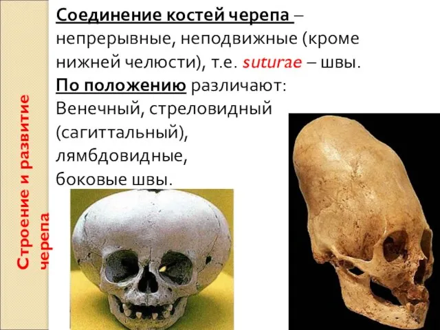 Строение и развитие черепа Соединение костей черепа – непрерывные, неподвижные (кроме нижней