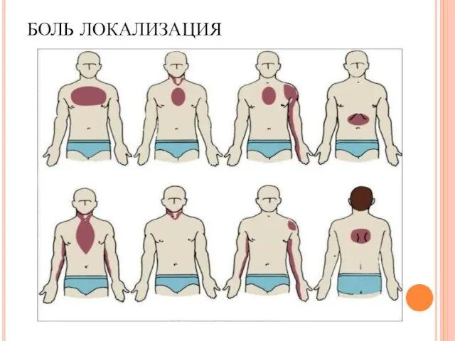 БОЛЬ ЛОКАЛИЗАЦИЯ