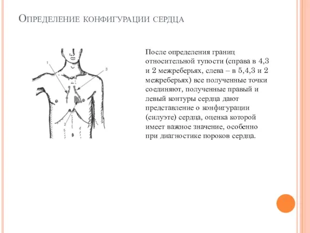 Определение конфигурации сердца После определения границ относительной тупости (справа в 4,3 и