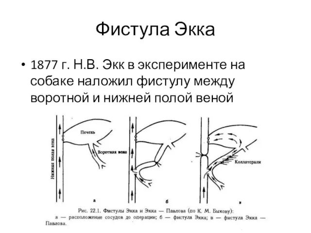 Фистула Экка 1877 г. Н.В. Экк в эксперименте на собаке наложил фистулу