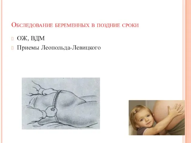 Обследование беременных в поздние сроки ОЖ, ВДМ Приемы Леопольда-Левицкого