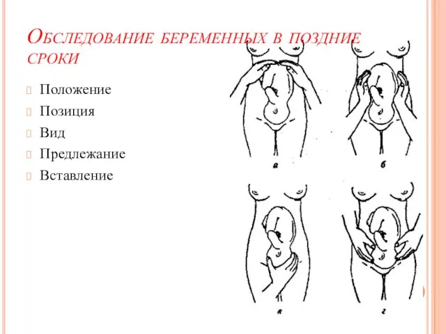 Обследование беременных в поздние сроки Положение Позиция Вид Предлежание Вставление