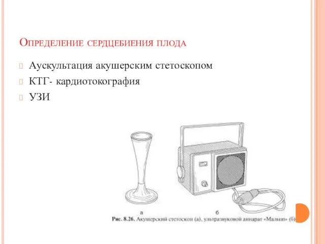 Определение сердцебиения плода Аускультация акушерским стетоскопом КТГ- кардиотокография УЗИ