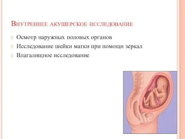 Внутреннее акушерское исследование Осмотр наружных половых органов Исследование шейки матки при помощи зеркал Влагалищное исследование