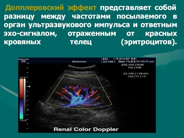 Допплеровский эффект представляет собой разницу между частотами посылаемого в орган ультразвукового импульса