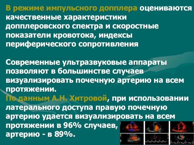 В режиме импульсного допплера оцениваются качественные характеристики допплеровского спектра и скоростные показатели