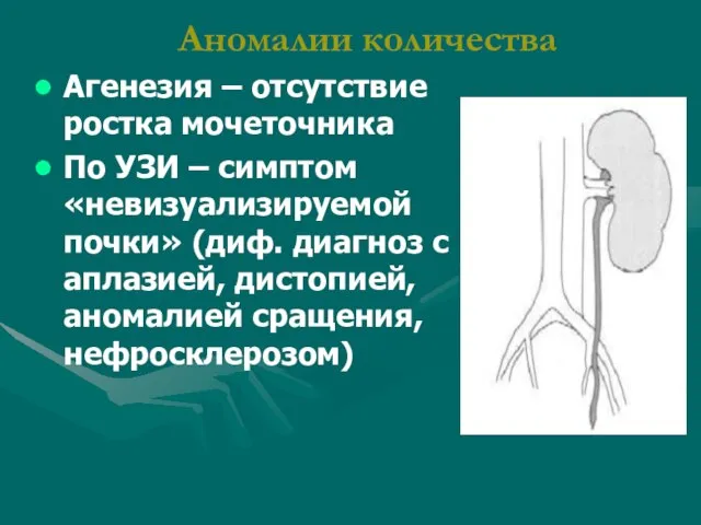 Аномалии количества Агенезия – отсутствие ростка мочеточника По УЗИ – симптом «невизуализируемой