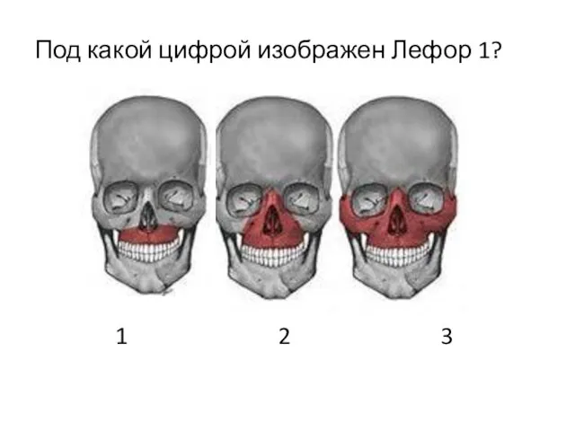 Под какой цифрой изображен Лефор 1? 1 2 3