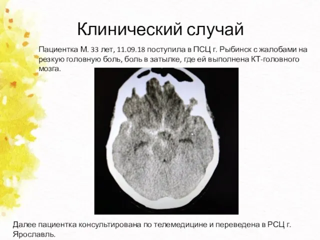 Клинический случай Пациентка М. 33 лет, 11.09.18 поступила в ПСЦ г. Рыбинск