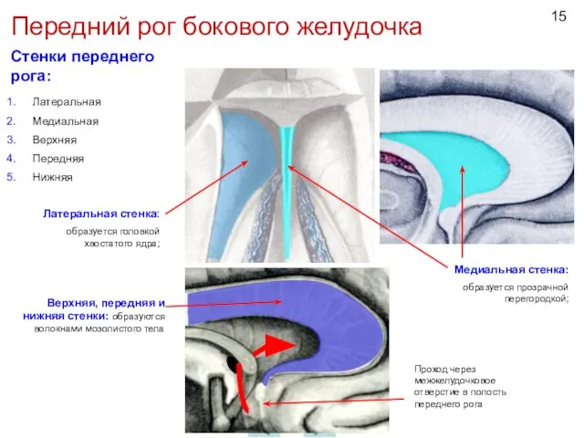 Передний рог бокового желудочка Латеральная Медиальная Верхняя Передняя Нижняя Медиальная стенка: образуется