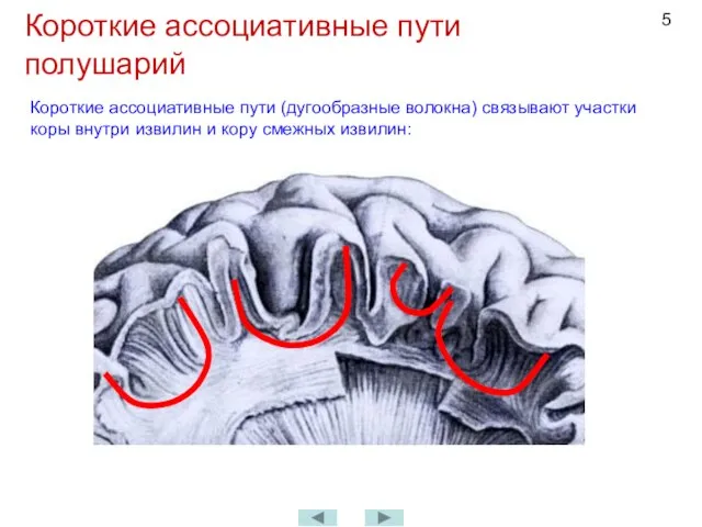 Короткие ассоциативные пути полушарий Короткие ассоциативные пути (дугообразные волокна) связывают участки коры