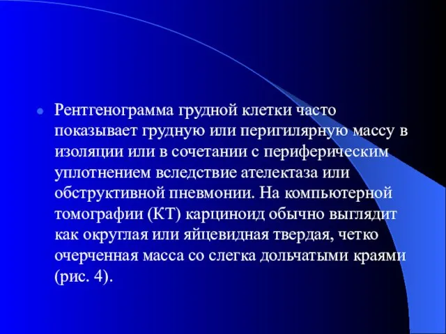 Рентгенограмма грудной клетки часто показывает грудную или перигилярную массу в изоляции или