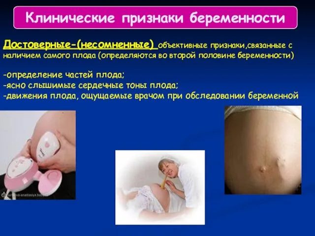 Клинические признаки беременности Достоверные-(несомненные) объективные признаки,связанные с наличием самого плода (определяются во