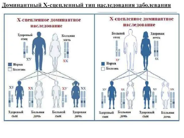 Доминантный Х-сцепленный тип наследования заболевания