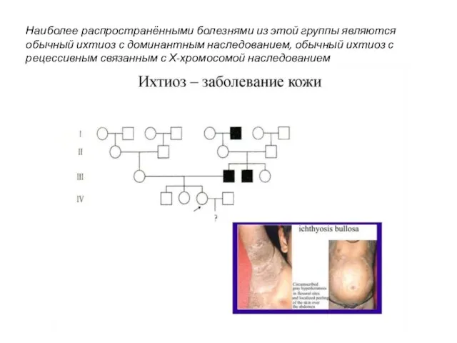 Наиболее распространёнными болезнями из этой группы являются обычный ихтиоз с доминантным наследованием,