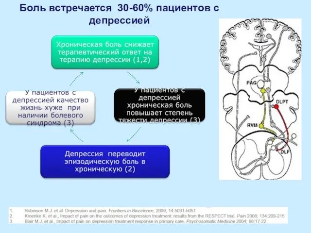 Боль встречается 30-60% пациентов с депрессией