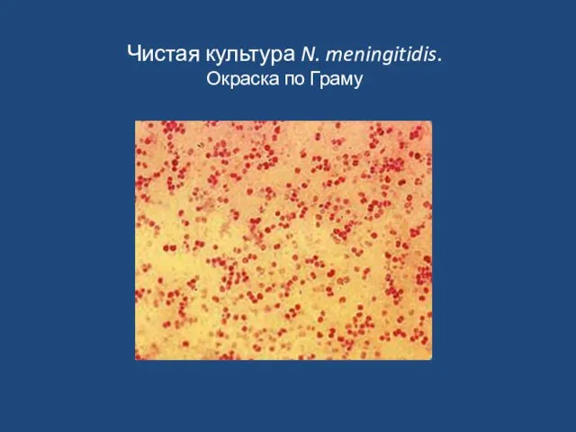 Чистая культура N. meningitidis. Окраска по Граму
