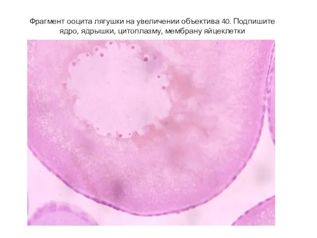 Фрагмент ооцита лягушки на увеличении объектива 40. Подпишите ядро, ядрышки, цитоплазму, мембрану яйцеклетки