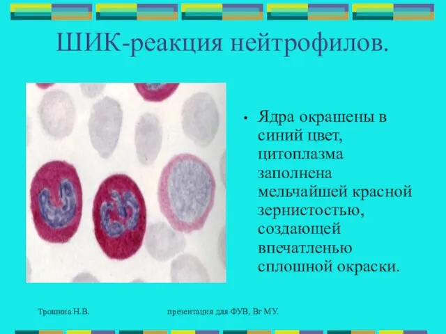 Трошина Н.В. презентация для ФУВ, Вг МУ. ШИК-реакция нейтрофилов. Ядра окрашены в