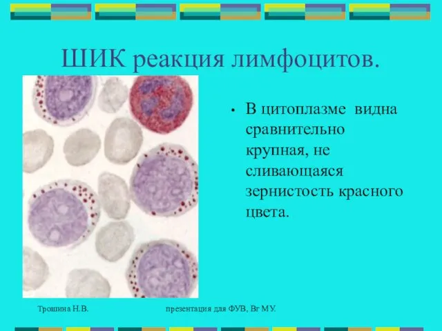 Трошина Н.В. презентация для ФУВ, Вг МУ. ШИК реакция лимфоцитов. В цитоплазме