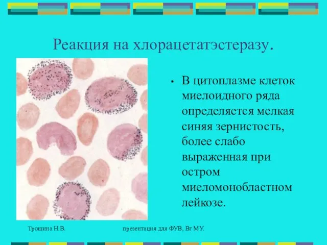 Трошина Н.В. презентация для ФУВ, Вг МУ. Реакция на хлорацетатэстеразу. В цитоплазме