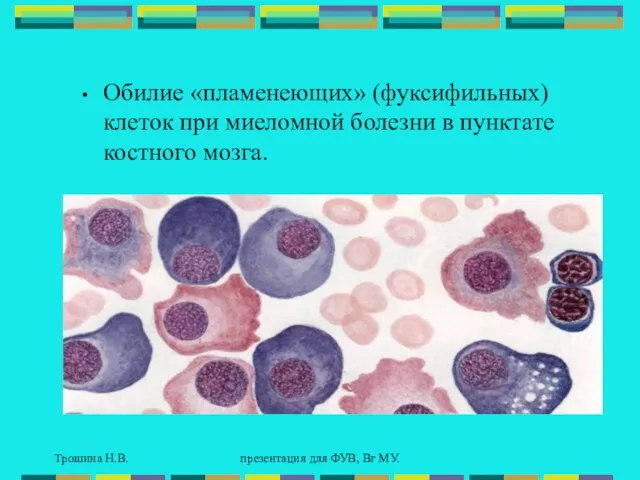 Трошина Н.В. презентация для ФУВ, Вг МУ. Обилие «пламенеющих» (фуксифильных) клеток при