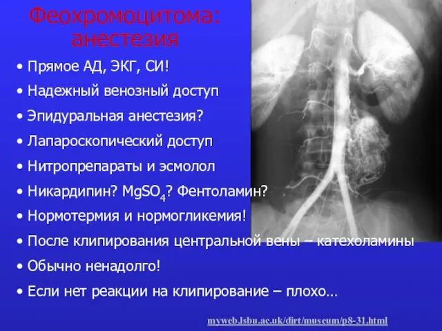 Феохромоцитома: анестезия myweb.lsbu.ac.uk/dirt/museum/p8-31.html Прямое АД, ЭКГ, СИ! Надежный венозный доступ Эпидуральная анестезия?