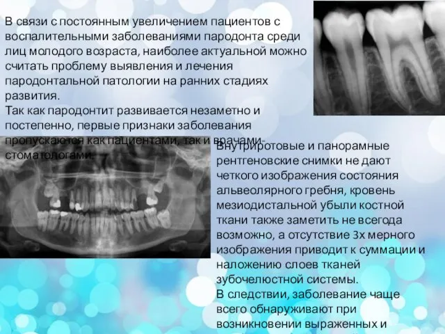 Внутриротовые и панорамные рентгеновские снимки не дают четкого изображения состояния альвеолярного гребня,