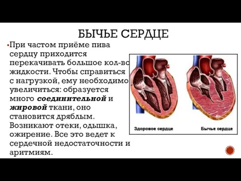 БЫЧЬЕ СЕРДЦЕ При частом приёме пива сердцу приходится перекачивать большое кол-во жидкости.