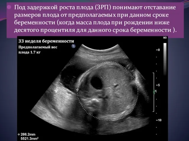 Под задержкой роста плода (ЗРП) понимают отставание размеров плода от предполагаемых при