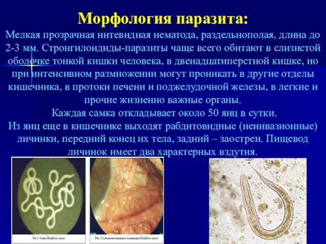 Морфология паразита: Мелкая прозрачная нитевидная нематода, раздельнополая, длина до 2-3 мм. Стронгилоидиды-паразиты
