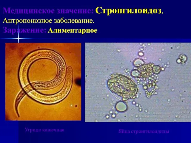 Медицинское значение: Стронгилоидоз. Антропонозное заболевание. Заражение: Алиментарное Яйца стронгилоидиды Угрица кишечная