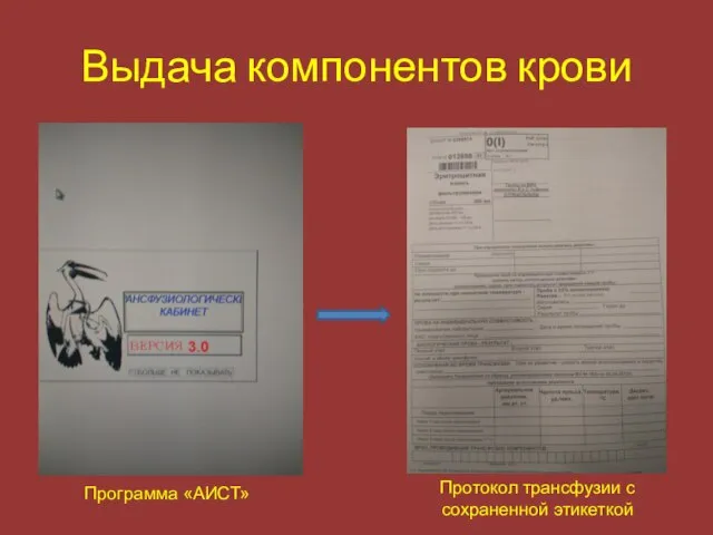 Выдача компонентов крови Программа «АИСТ» Протокол трансфузии с сохраненной этикеткой