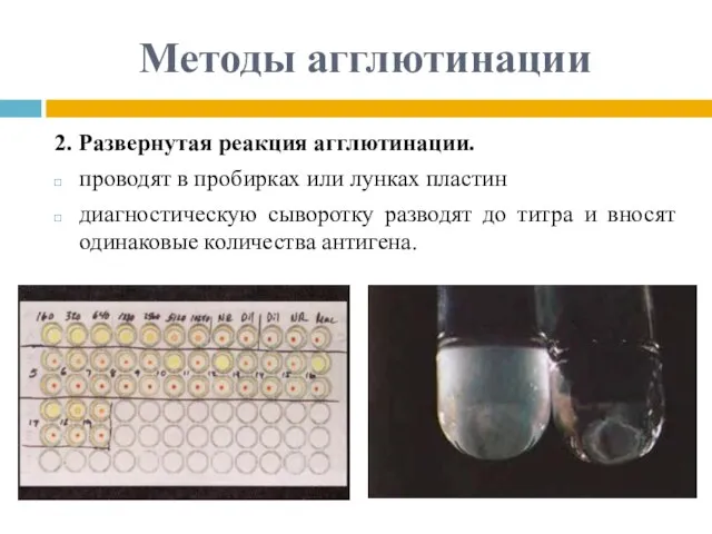 Методы агглютинации 2. Развернутая реакция агглютинации. проводят в пробирках или лунках пластин