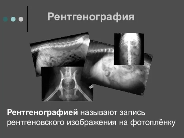 Рентгенография Рентгенографией называют запись рентгеновского изображения на фотоплёнку