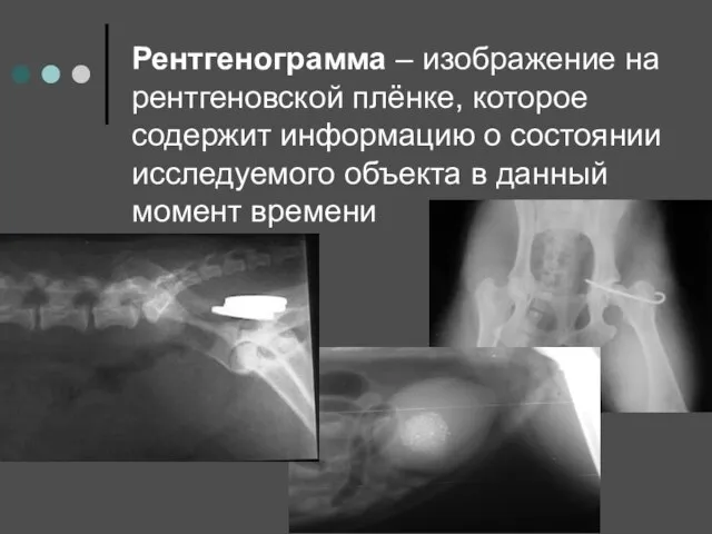 Рентгенограмма – изображение на рентгеновской плёнке, которое содержит информацию о состоянии исследуемого