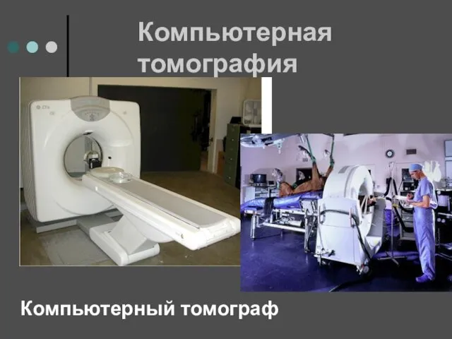 Компьютерная томография Компьютерный томограф