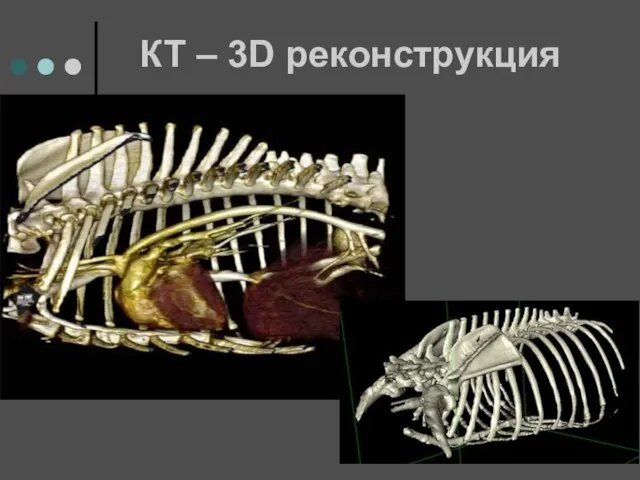 КТ – 3D реконструкция