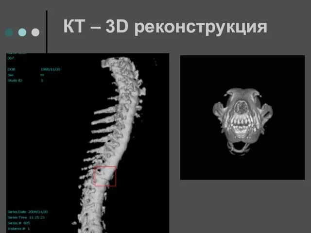 КТ – 3D реконструкция