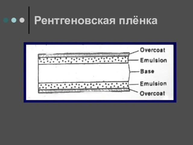 Рентгеновская плёнка