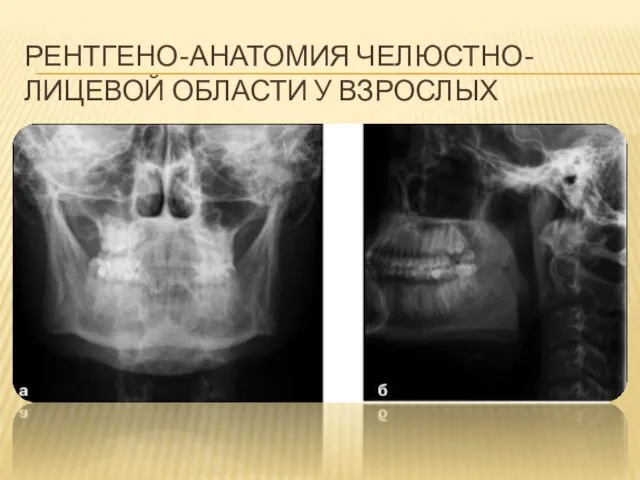 РЕНТГЕНО-АНАТОМИЯ ЧЕЛЮСТНО- ЛИЦЕВОЙ ОБЛАСТИ У ВЗРОСЛЫХ