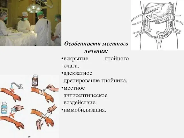 Особенности местного лечения: вскрытие гнойного очага, адекватное дренирование гнойника, местное антисептическое воздействие, иммобилизация.