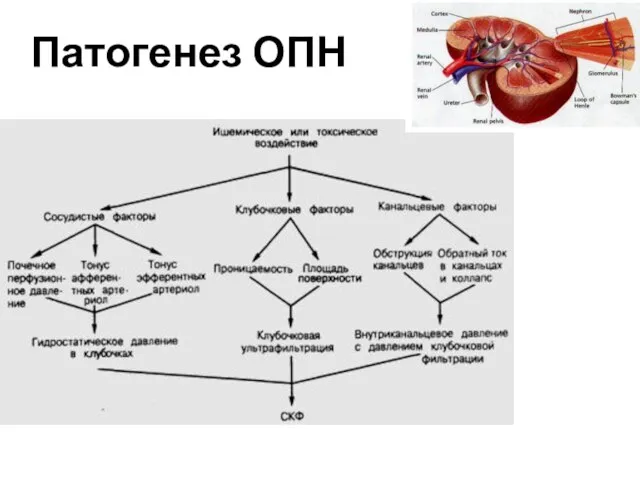 Патогенез ОПН